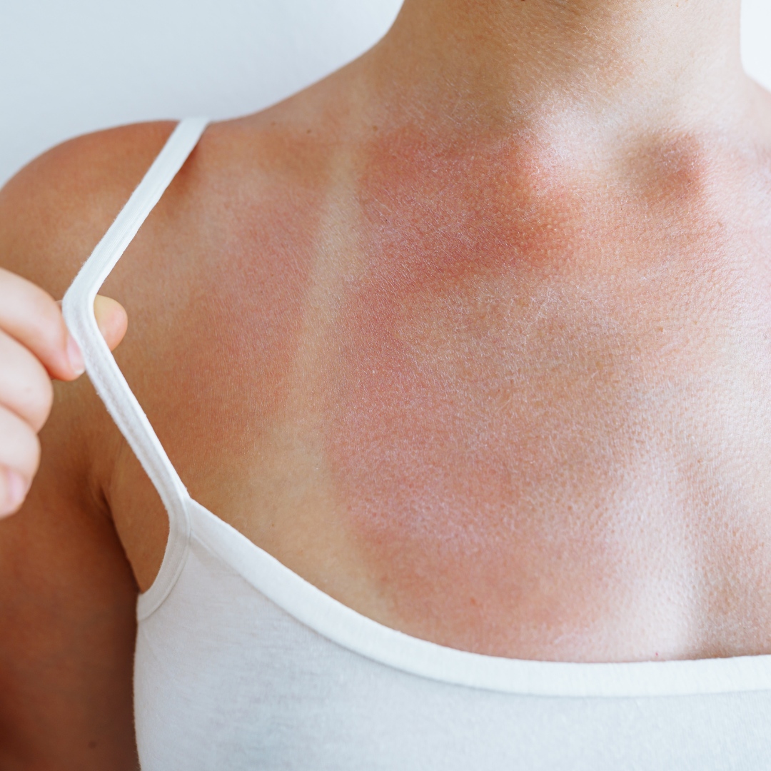 Gel Calmante y Refrescante con Aloe Vera, Romero y Menta