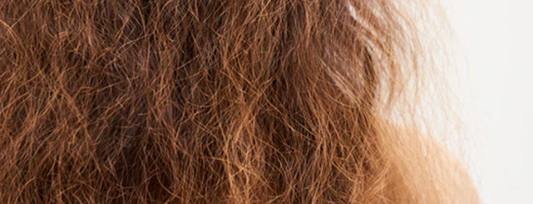 El frizz capilar no se elimina… se equilibra